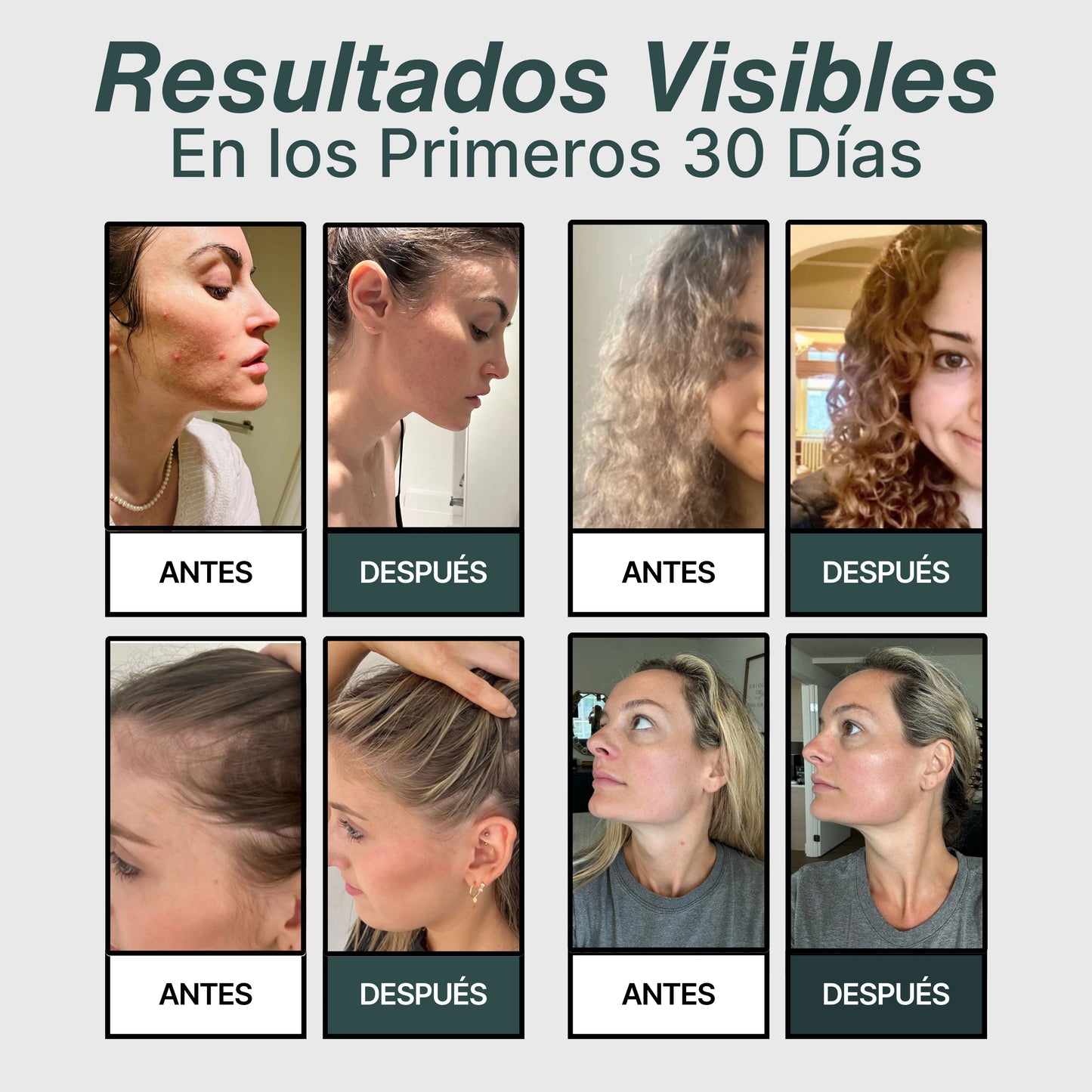Salva Tu Piel, Tu Pelo y Tu Salud del Desastre con Oasis