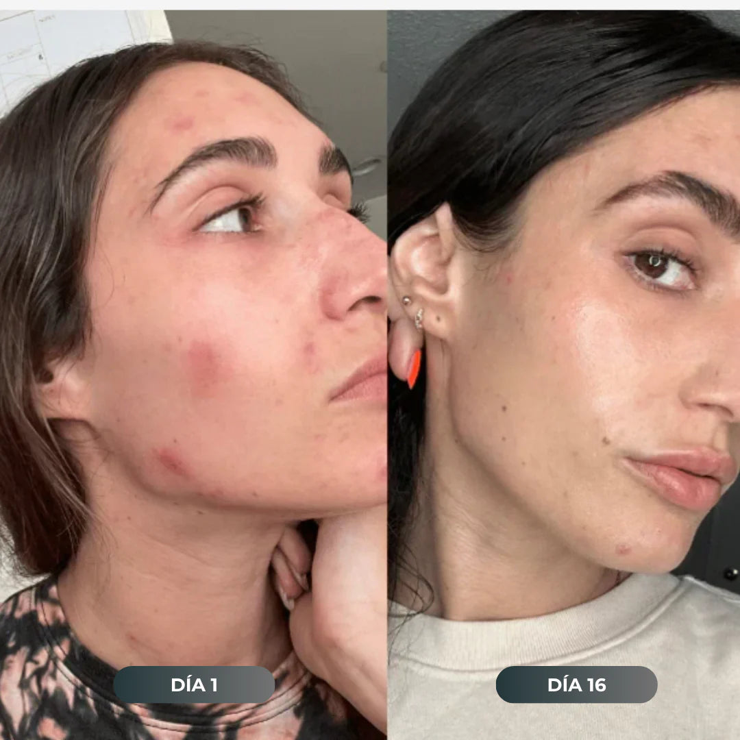 Resultado de María después de usar Oasis