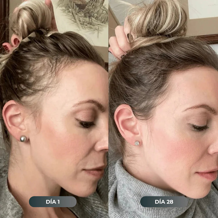 Resultado en el cabello después de 28 días