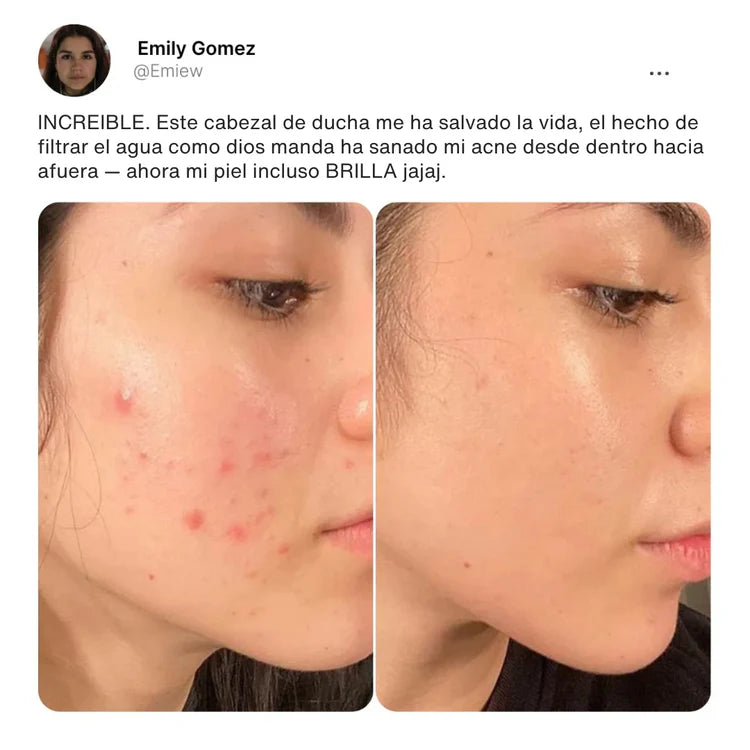 Resultado de Emily Gomez antes y después